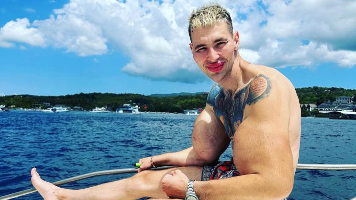 La dramática confesión del “Popeye ruso”, quien podría perder los dos brazos: “Cometí una estupidez”