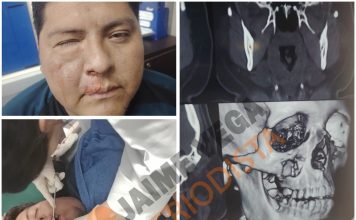 Un fracturado, gases, balas de goma y un DT argentino entre los 17 expulsados: el video de la batalla campal en Bolivia