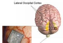 Logran que una persona ciega recupere parte de la visión con microestimulación cerebral